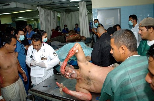 洪都拉斯發生世界百年來最嚴重監獄火災 至少359人死亡