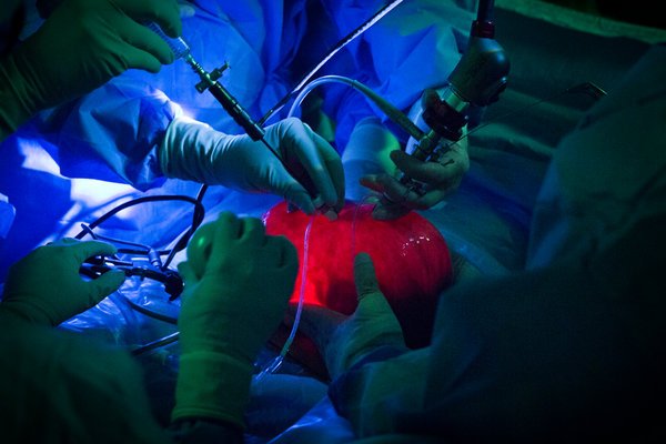 雙語(yǔ)盤(pán)點(diǎn)：2017年，我們了解到哪些科學(xué)新知？