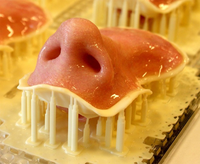 外部創(chuàng)傷患者福音：3-D打印鼻子、耳朵誕生